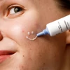 Kép 4/5 - Mossa Acne Act pattanáskezelő fluid (15 ml)