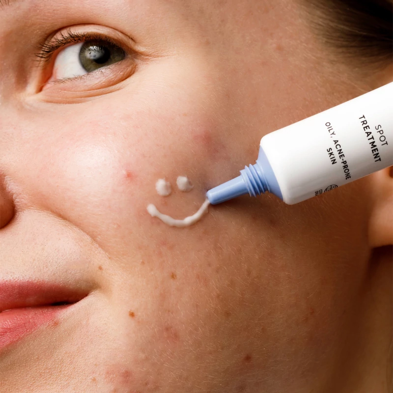 Mossa Acne Act pattanáskezelő fluid (15 ml)
